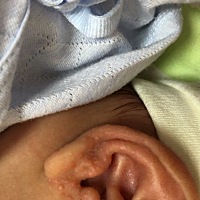 宝宝外耳道长这个，是什么呀？