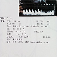 不管男女，健康就好，宝宝会不会太小了。