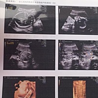 前几天做的四维麻烦能看懂的帮我看看👀是男孩还是女孩，谢谢