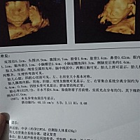 四维，图1大宝，图2小宝