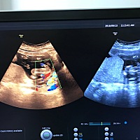 有b超医生吗？帮忙看看男宝还是女宝宝