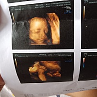 新鲜出炉的四维。看那鼻子和眼睛，还有嘴巴好像他哥哥啊！