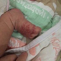 这个是血管瘤吗？