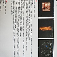 二宝，四维不配合折腾了好几次，朋友们能看出是男宝女宝吗？