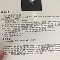 刚做好的二维，想知道男女😄😄😄😄，哪位孕妈会看啊？