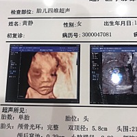 四维顺利通过！开心～大家帮忙看看是男宝宝还是女宝宝，很好奇…… 大夫说宝宝像爸爸，嘿嘿😁