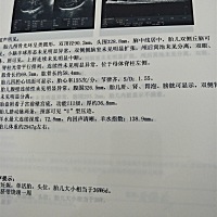 有会看的吗，男宝还是女宝呢