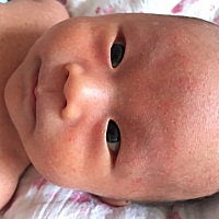 宝宝还没满月，脸上头上脖子上起了好像是湿疹，一吃奶脸上耳朵后面还有脖子上就有很多小疙瘩很红，看着...