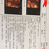 四维和四维复查，有谁能帮我看看男孩女孩吗？谢谢各位啦！