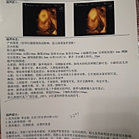 四维终于做了，宝宝脐带绕颈一圈，希望自己乖乖绕出来。胎盘距离宫颈口才46mm,记得做nt时是靠近宫颈口，...