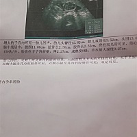 17 5宝妈们看看是男是女