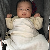 百度看唐宝宝症状，都快要怀疑我儿子是唐宝宝了😒，大家看像吗？？