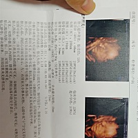 亲们能看出来男孩女孩吗？