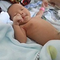 恐惧症，伤口还在痛，今天要拆线了，小孩吃奶既然乳头出血了，还可以喂奶吗