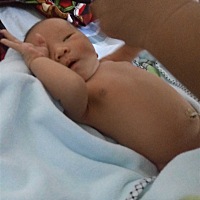 月子天天吃鸡，感觉好腻，能不能吃水果，今天去医院拆线，搞得我昨晚一个晚上满脑多种痛的想法的恐惧症...