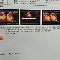 各位孕妈，来看看这是男是女？？