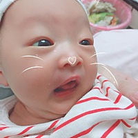 各位宝妈我家宝宝黄疸高怎么办，你们有什么方法解决..可以给我说一下吗？谢谢