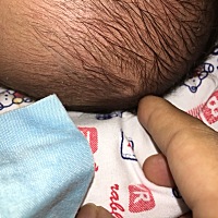 新生儿宝宝头顶上突出个疙瘩是怎么回事儿？有知道的吗？