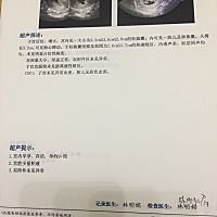 宫颈少量积液 医生开头孢克洛分散片 说明说妊妇不可以吃 可以吃吗？