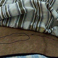 第一胎伤口很小，第二胎直接给我加了这么长的伤口！痛啊！