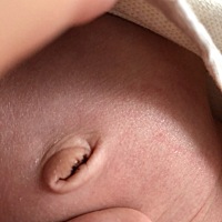 宝妈们 肚脐眼退掉之后还有点血痂正常吗。