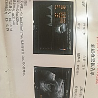 9周加6天了，还要去医院检查？