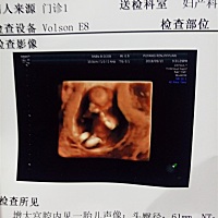 宝贝真棒NT通过