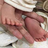 问大家胀奶 奶头不通 有没有什么好办法