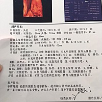 有人看得懂男女的吗？  求大神告知。谢谢啦……
