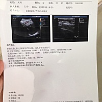各位帮忙看看，一胎剖腹产，现在疤痕厚度只有1.2mm 有点担心。羊水偏多也不知道什么情况，这次检查越发...