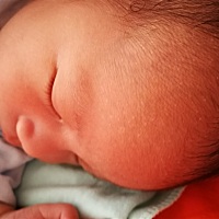 宝宝额头上长了很多这种白色小白点请问各位宝妈有没懂的？是什么？