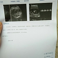 11周 5去做的NT感觉这个单子写的好简单，姐妹们你们的NT单都写的啥？