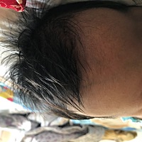 宝宝51天了，昨天给剃了光头，哈哈，小家伙是油发，洗了一天的头发就跟一两个星期没洗的一样，实在...