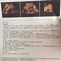 帮忙是男宝还是女宝？，