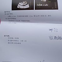 为什么我做的NT这么简单～～两分钟搞定～