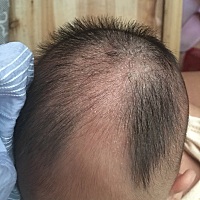 宝宝两个多月，头上不知道是干的还是脏的，洗不掉，又不敢给她抓，咋办呀？