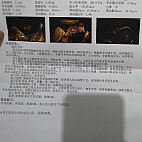 四维顺利通过！这个四维做的宝宝的脸都看不清啊。。