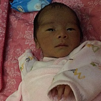 眼头上面有三个红点，睡觉时候比较淡，一哭起来就变红很多，有哪个知道什么来的吗？      男宝宝，感觉...