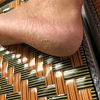 脚后面裂口了。太干燥了吗？有什么方法可以缓解。怀孕35周了。