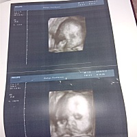 四维一次通过，有会看男女的吗？可以看宝宝多重吗