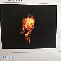 怀孕23周  大宝是女孩👧很希望二宝是男宝  做四维彩超说是女宝  忍不住掉眼泪  努力调整心态接受二宝