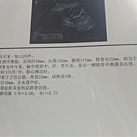 今天去检查了，现在16周多，谁能看出是男孩女孩，虽然都喜欢，但是很想知道，才好准备准备😊😊