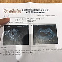 大家帮我看一下 大概是男孩还是女孩