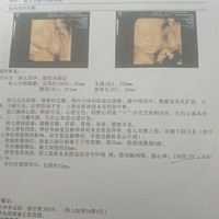 接四维顺利通过。有宝妈能看出男女嘛。