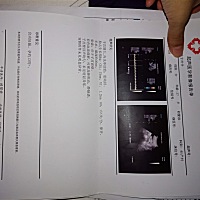 帮忙看看是男孩女孩