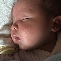 请教各位宝妈，我家宝宝脸上红色的痘痘是怎么回事？需要用什么药吗？