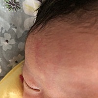 急急急，请知道的宝妈们帮我解答一下，刚出生二天的宝宝，额头上这是什么？出生那天就有了，我是顺产的...