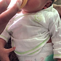 ✌️ 我们18天了，黄疸退的差不多了，慢慢上奶变白白。