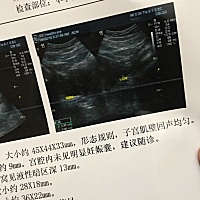 今天去医院检查 42天 b超没看到孕囊   医生说是怀孕了 但是确定不了是宫内宫外 我没有出血 只是小腹有点...