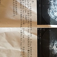 9月23号到29号是排卵期 哪天同房能怀上宝宝 这是今天和昨天做的卵泡跟踪